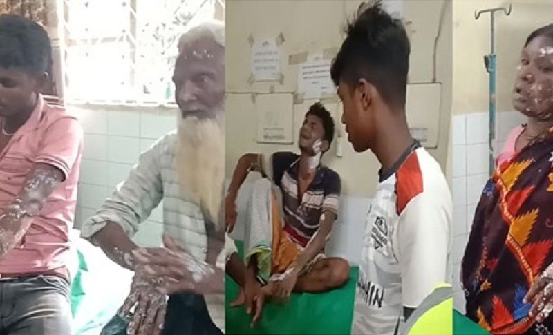 গোদাগাড়ীতে গ্যাসের বেলুন বিস্ফোরণে গুরুতর দগ্ধ ৭
